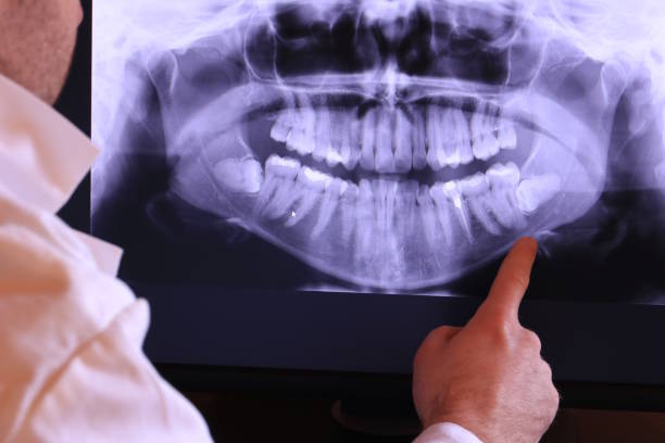 Best Emergency Root Canal Treatment in Massanetta Springs, VA