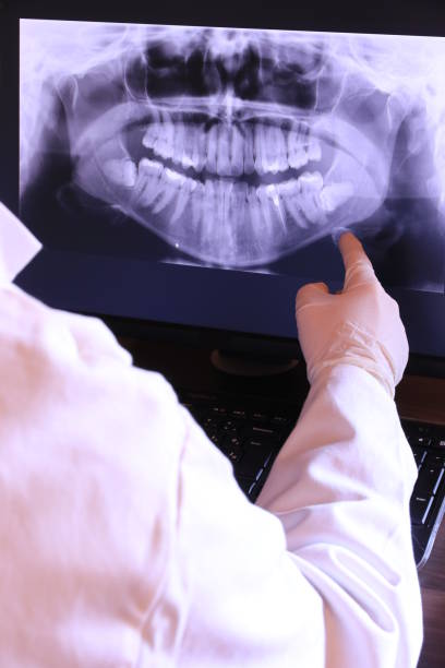 Best Emergency Dental Care for Abscessed Tooth in Massanetta Springs, VA